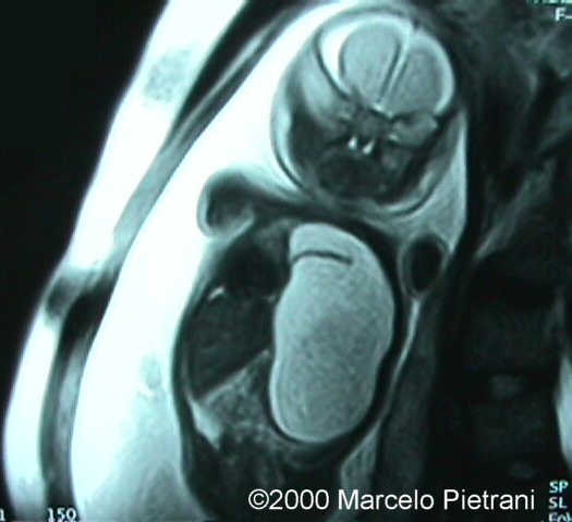 case0029-5