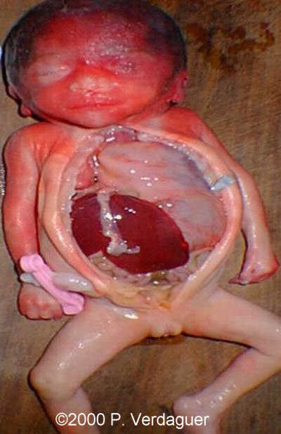 case0029-7