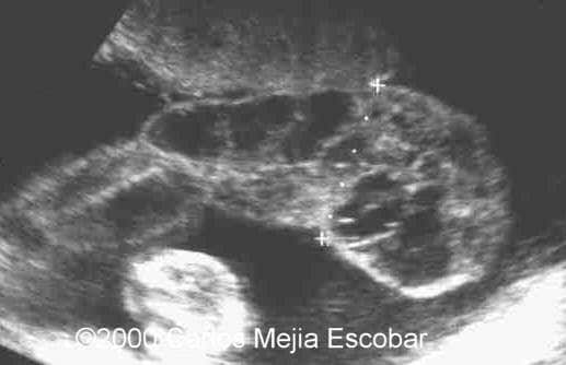 case0030-1