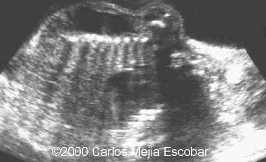 case0030-3
