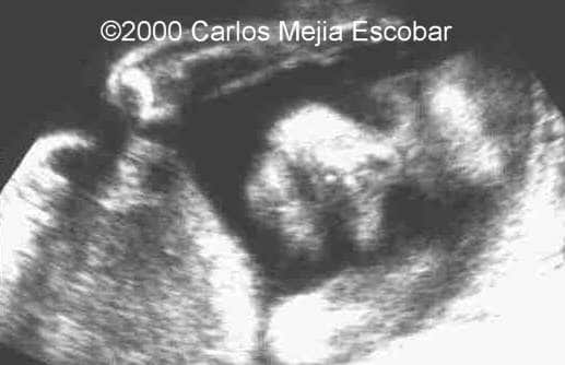 case0030-4