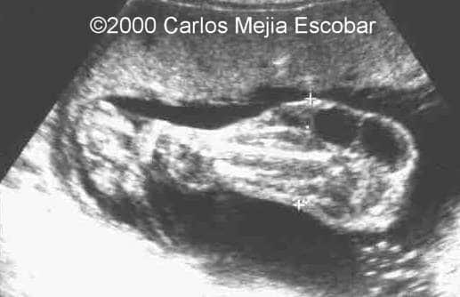 case0030-5