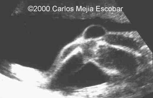 case0030-6