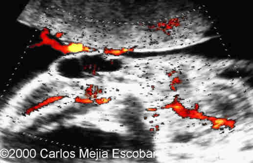case0030-7