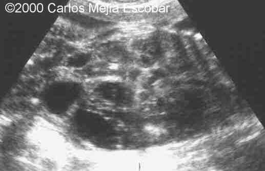 case0030-9