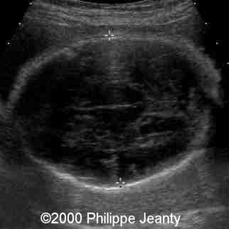 case0031-10
