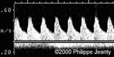 case0031-11