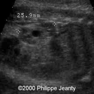 case0031-12
