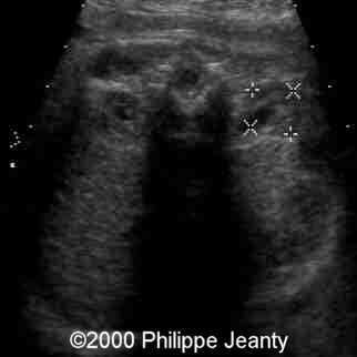 case0031-13