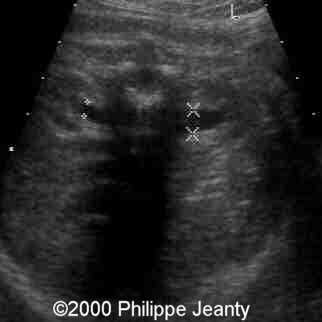 case0031-14