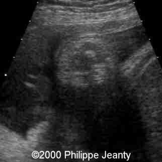 case0031-15