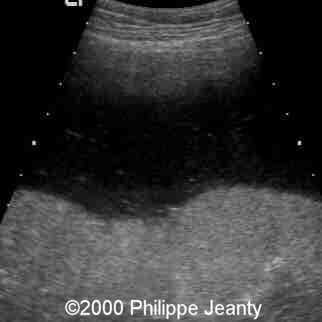 case0031-16