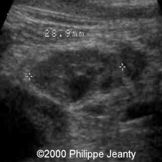 case0031-18