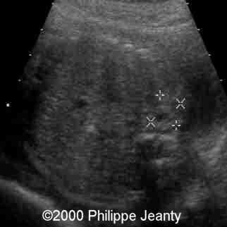 case0031-3