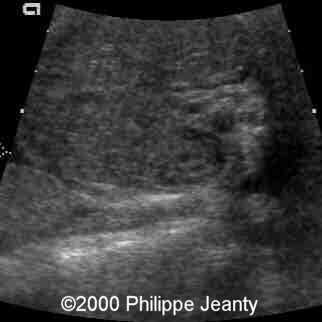 case0031-5