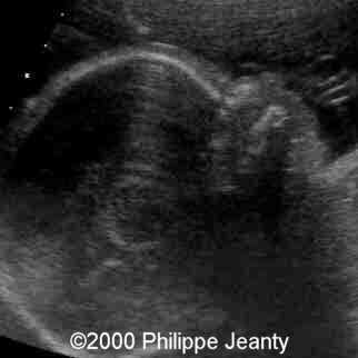 case0031-9