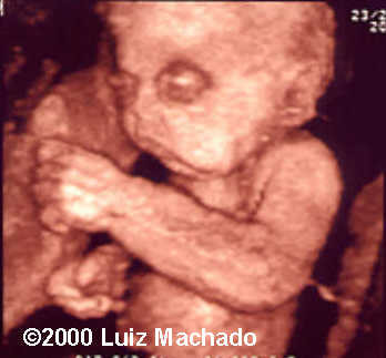 case0032-4
