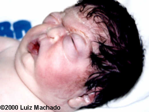 case0032-8