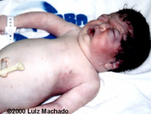 case0032-9