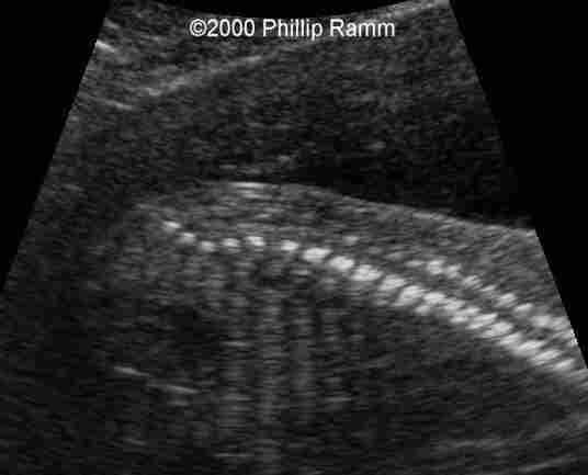 case0034-1