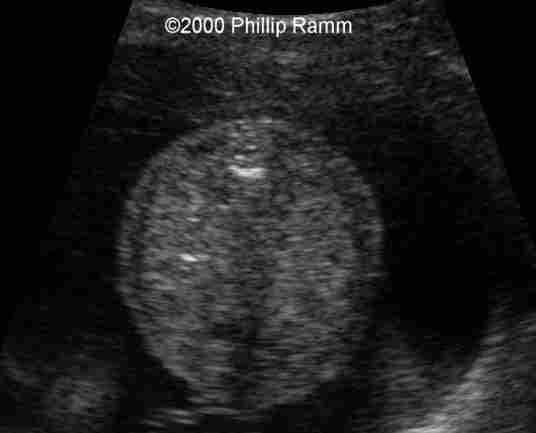 case0034-2