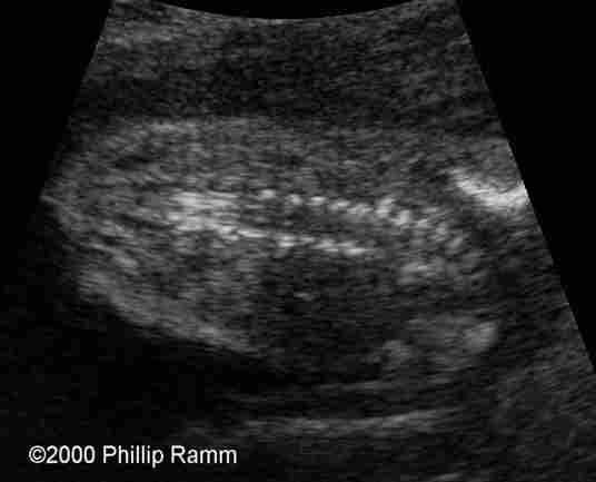 case0034-3