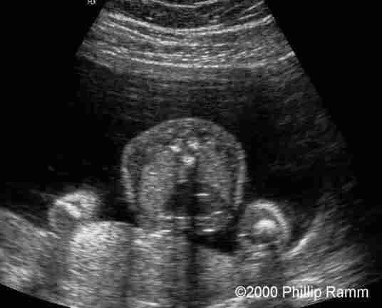 case0034-4