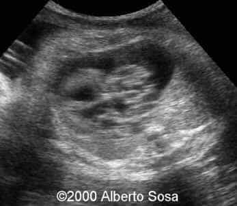 case0036-2
