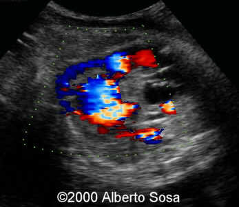 case0036-5