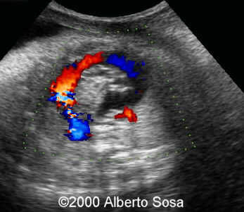 case0036-6