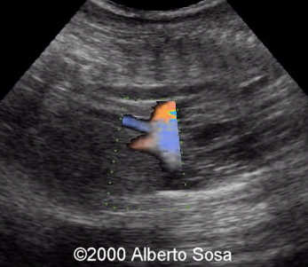 case0036-9