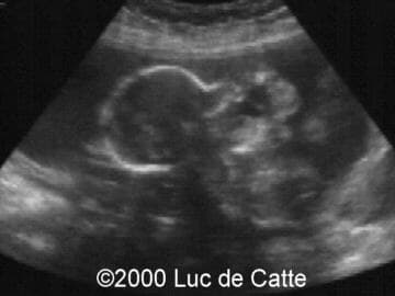 Case0037-2