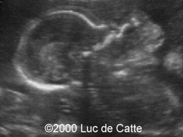 Case0037-3