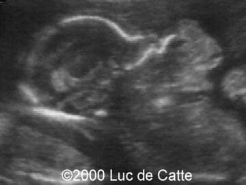 Case0037-4