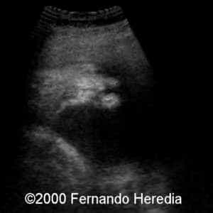 case0038-10