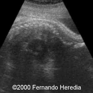 case0038-15
