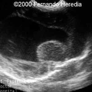 case0038-17