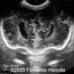 case0038-18