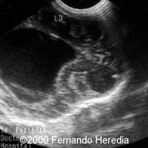 case0038-19