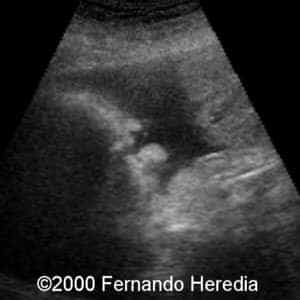 case0038-2