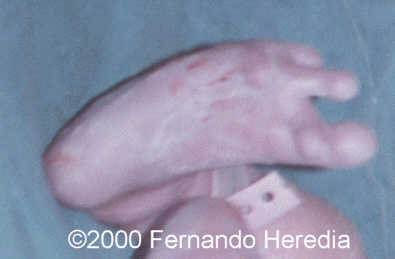 case0038-24