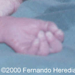 case0038-26