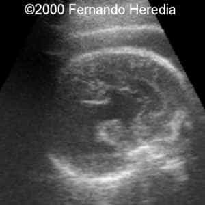 case0038-3