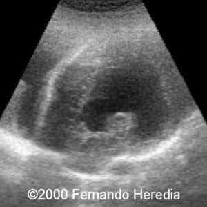 case0038-8