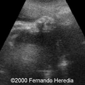 case0038-9