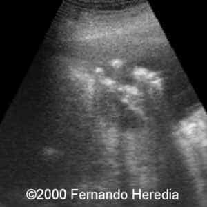 case0038-9b