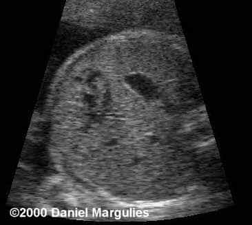 case0039-1
