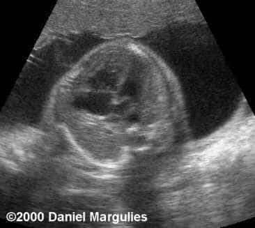 case0039-11