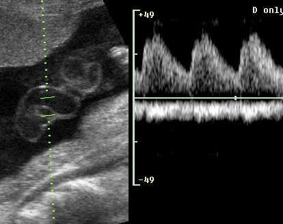 case0039-12