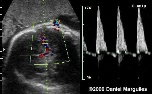 case0039-6